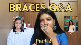 My Retainer Routine & Honest Q&A | Part 2 