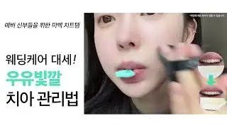 결혼식에서 활짝 웃어도 굴욕없는 관리법