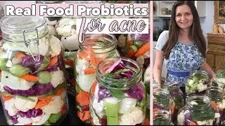 Real Food Probiotics for Acne | Romanian Muraturi Recipe | Clear Skin Diet