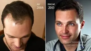 Интервью с доктором клиники RTH Цхай И.В.
