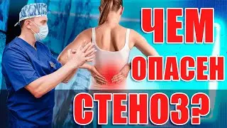 Стеноз, какие последствия не лечения? Ответы на вопросы