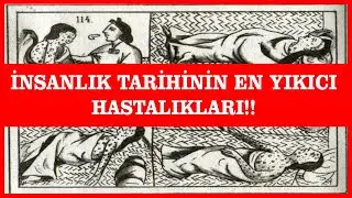 İNSANLIK TARİHİNİN EN YIKICI HASTALIKLARI!!