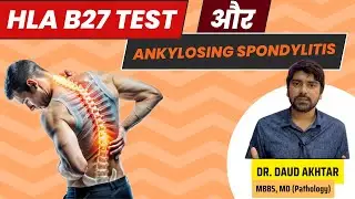 HLA B27 test  and Ankylosing Spondylitis - Full Information (IN HINDI)