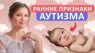 Как понять, что ребенок ОСОБЕННЫЙ / Основные признаки аутизма у детей!