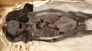 Scientists Finally Know the Tragic Reason the Screaming Mummy Has Been in Agony for 3,500 Years