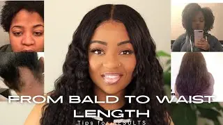 From BALDING To WAIST LENGTH: BEATING Alopecia! | Plus Hair Goal Tips!!! (UPDATED!!!)