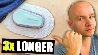 Restart Dexcom G6 Sensor | 2 Ways That Work in 2026