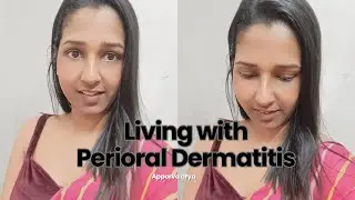 Living with Perioral Dermatitis | Treatment | Natural Cure | my Derma Guide *detail video*