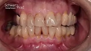 Horizontal and Vertical Defects part 1 of 2