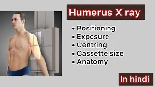 Humerus X-ray Detail explanation In hindi