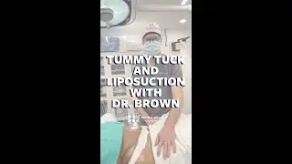 Back Liposuction & Tummy Tuck Transformation [Witness the Tightening and Sculpting Process]