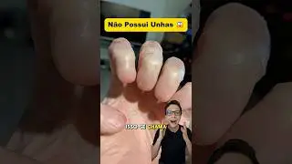 Não Possui Unhas 😱