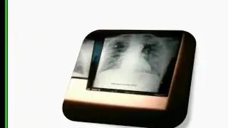 POWER POINT PRESENTATION (MEDICAL)