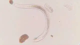 Counting all the worms.