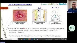 Neutrophil Extracellular Traps (NETs) by Dr  Meraj