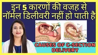 इन 5 कारणों की वजह से नॉर्मल डिलीवरी नहीं हो पाती है | TOP 5 CAUSES OF C-SECTION DELIVERY