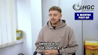 Nathan’s Hair Transplant Journey | From Confidence Struggles to Full Hair with Hair Growth Centre