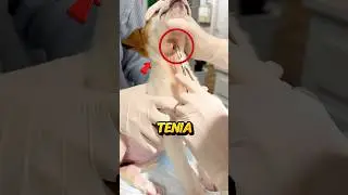Months of pain… and finally freedom for this little dog 💔🐕✨