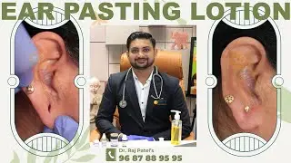 Ear lobe repair kaise kare👂👂 | ear pasting Treatment | कान के बढ़े हुए छेद बंद करें | #earloberepair