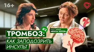 ТРОМБОЗ: как заподозрить инсульт. Что такое ТИА (транзиторная ишемическая атака)?