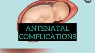 Antenatal Pregnancy complications part 12, Rhesus isoimmunization 