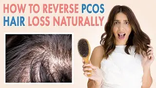 PCOS Hair Loss Treatment | Causes + Products + Natural Remedies TO GROW BACK YOUR HAIR