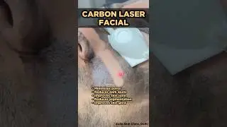 Skin Glow Laser | Carbon Laser Facial | Carbon Laser Treatment | Carbon Peel | Skin Clinic Delhi