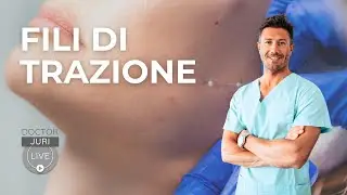 Fili di trazione