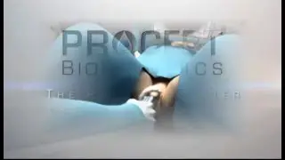 Aquablation – image-guided robot-assisted waterjet ablation of the prostate