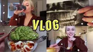 ΕΡΧΟΜΑΙ ΕΛΛΑΔΑ!! + τελική απόφαση σιδεράκια [vlog]