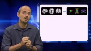 The Connectome in the Human Brain: Defining its Heritability and Association with ADHD