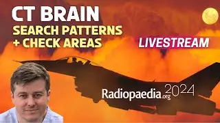 Brain CT: search patterns and check areas with Andrew Dixon