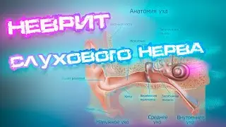 Auditory neuritis: causes, consequences, and treatment? 