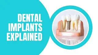 Why choose implants? Dental Implants explained.