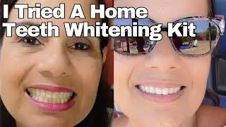 Brite Whitening Teeth Whitening Home Kit Review