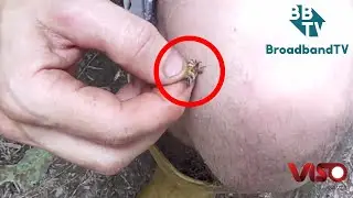 ABEJAS PARA EL DOLOR ACUPUNTURA
