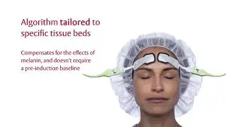 ForeSight Elite tissue oximetry system overview