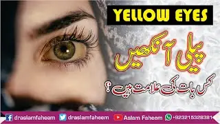 Yellow Eyes Without Jaundice & its Treatment in Urdu l Hindi | How to get Rid of Yellow Eyes