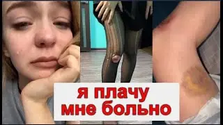 МАША МАЕВА СЛОМАЛА НОГУ! РАЗОРВАЛА СВЯЗКИ / ЧТО СЛУЧИЛОСЬ С МАШЕЙ МАЕВОЙ?