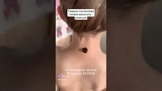 Как дети реагируют на пиявку