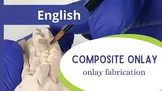 Composite onlay - part 4: onlay fabrication.
