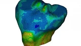 ANSYS MESH TOOLS – VIRTUAL TOPOLOGY