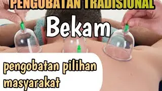 manfaat bekam tubuh tradisional