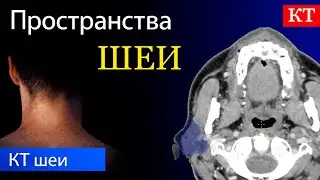 Пространства шеи на КТ