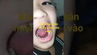 Bệnh tay chân miệng đang vào mùa || BS Nam Hưng Yên