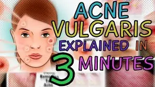 ACNE VULGARIS | WHAT IS ACNE? ACNE TREATMENT | ACNE SYMPTOMS | DERMATOLOGY | WHAT ARE COMEDONES?