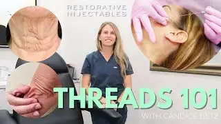 PDO Threads 101 - Are They Really Worth It? What Are PDO Threads? Do They Really Work?