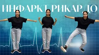 Шпаргалка по ЭКГ – ECG dance