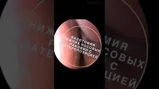 Вазотомияни нижних носовых раковин с латеропозиией. Андрей Боклин.