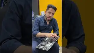 سبب الفراغ بين الرامات